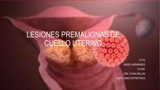 LESIONES PREMALIGNAS DE
CUELLO UTERINO
(I.P.G)
ÁNGEL HERNÁNDEZ
TUTOR:
DRA. VIVIAN MILLÁN
ESPC: GINECOSTRETRICIA
 