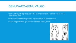 GENUVARO-GENUVALGO
 Son cuadros patológicos que afectan la alineación de las rodillas, y cada uno es
contrario al otro.
 Genu varo: “Rodillas Arqueadas” o que se alejan de la línea media
 GenuValgo “Rodillas que chocan” o rodillas juntas, en “X”.
 