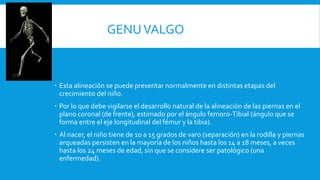GENUVALGO
 Esta alineación se puede presentar normalmente en distintas etapas del
crecimiento del niño.
 Por lo que debe vigilarse el desarrollo natural de la alineación de las piernas en el
plano coronal (de frente), estimado por el ángulo femoro-Tibial (ángulo que se
forma entre el eje longitudinal del fémur y la tibia).
 Al nacer, el niño tiene de 10 a 15 grados de varo (separación) en la rodilla y piernas
arqueadas persisten en la mayoría de los niños hasta los 14 a 18 meses, a veces
hasta los 24 meses de edad, sin que se considere ser patológico (una
enfermedad).
 