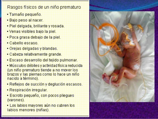ansiedad e hipertensión son un problema serius?