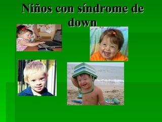 Niños con síndrome de down 
