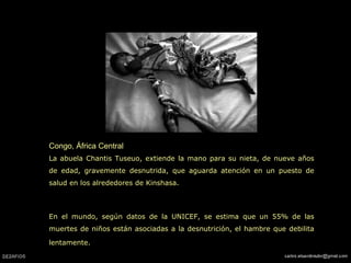 Congo, África Central La abuela Chantis Tuseuo, extiende la mano para su nieta,  de nueve años de edad,   gravemente desnutrida,  que aguarda atención en un puesto de salud en los alrededores de Kinshasa.  En el mundo, según datos de la UNICEF, se estima que un 55% de las muertes de niños están asociadas a la desnutrición, el hambre que debilita lentamente.   