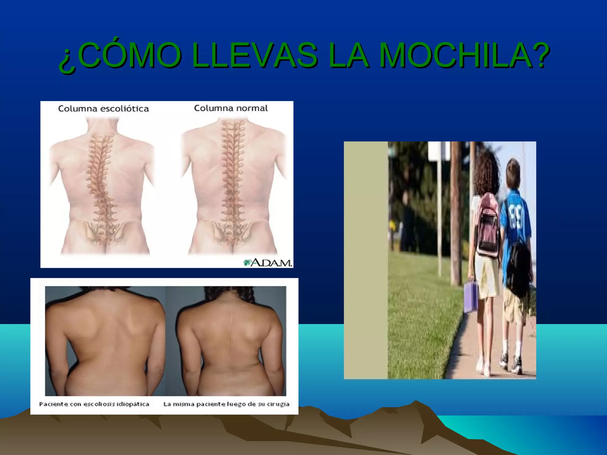 ¿CÓMO LLEVAS LA MOCHILA?¿CÓMO LLEVAS LA MOCHILA?
 