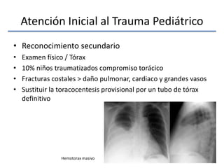 Atención Inicial al Trauma Pediátrico
• Reconocimiento secundario
• Examen físico / Tórax
• 10% niños traumatizados compromiso torácico
• Fracturas costales > daño pulmonar, cardiaco y grandes vasos
• Sustituir la toracocentesis provisional por un tubo de tórax
definitivo
Hemotorax masivo
 