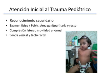 Atención Inicial al Trauma Pediátrico
• Reconocimiento secundario
• Examen físico / Pelvis, Área genitourinaria y recto
• Compresión lateral, movilidad anormal
• Sonda vesical y tacto rectal
 