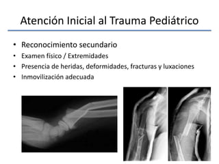 Atención Inicial al Trauma Pediátrico
• Reconocimiento secundario
• Examen físico / Extremidades
• Presencia de heridas, deformidades, fracturas y luxaciones
• Inmovilización adecuada
 