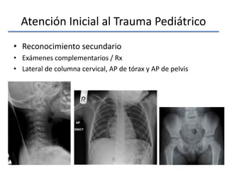 Atención Inicial al Trauma Pediátrico
• Reconocimiento secundario
• Exámenes complementarios / Rx
• Lateral de columna cervical, AP de tórax y AP de pelvis
 