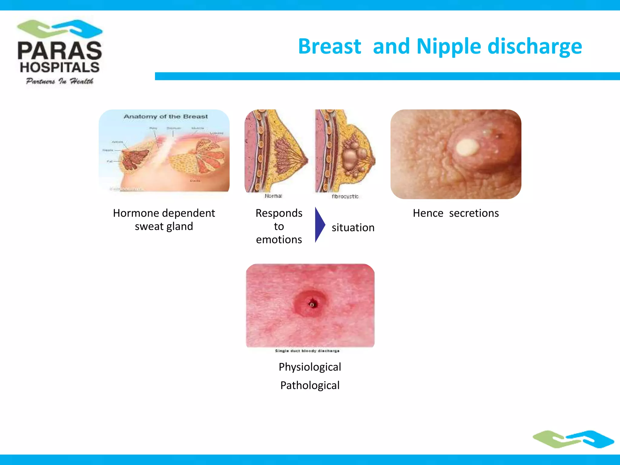 Nipple discharge in reproductive age group women | PPTX