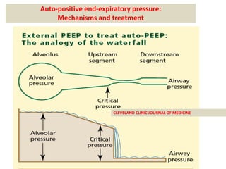 Auto-positive end-expiratory pressure:
     Mechanisms and treatment




                      CLEVELAND CLINIC JOURNAL OF MEDICINE
 
