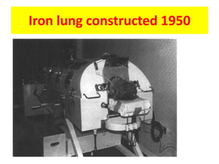 Iron lung constructed 1950
 