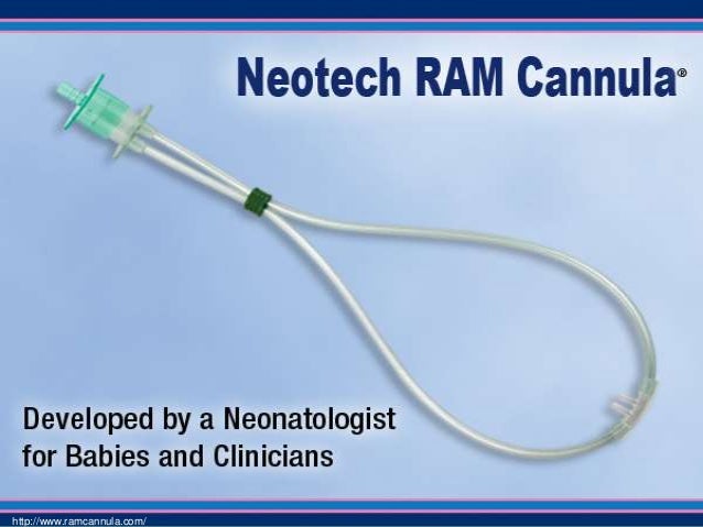 non invasive ventilation for preterm infants ram cannula size chart