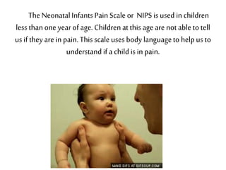 The NeonatalInfantsPainScale or NIPS is used in children
less thanone year of age.Children at this age are not able to tell
us if they are in pain. This scale uses body languageto help us to
understandif a childis in pain.
 