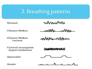 3. Breathing patterns
 
