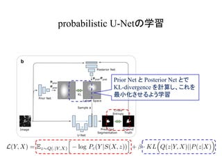 probabilistic U-Net
Prior Net Posterior Net
KL-divergence
 