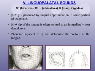 sound production in prosthodontics in complete denture | PPT