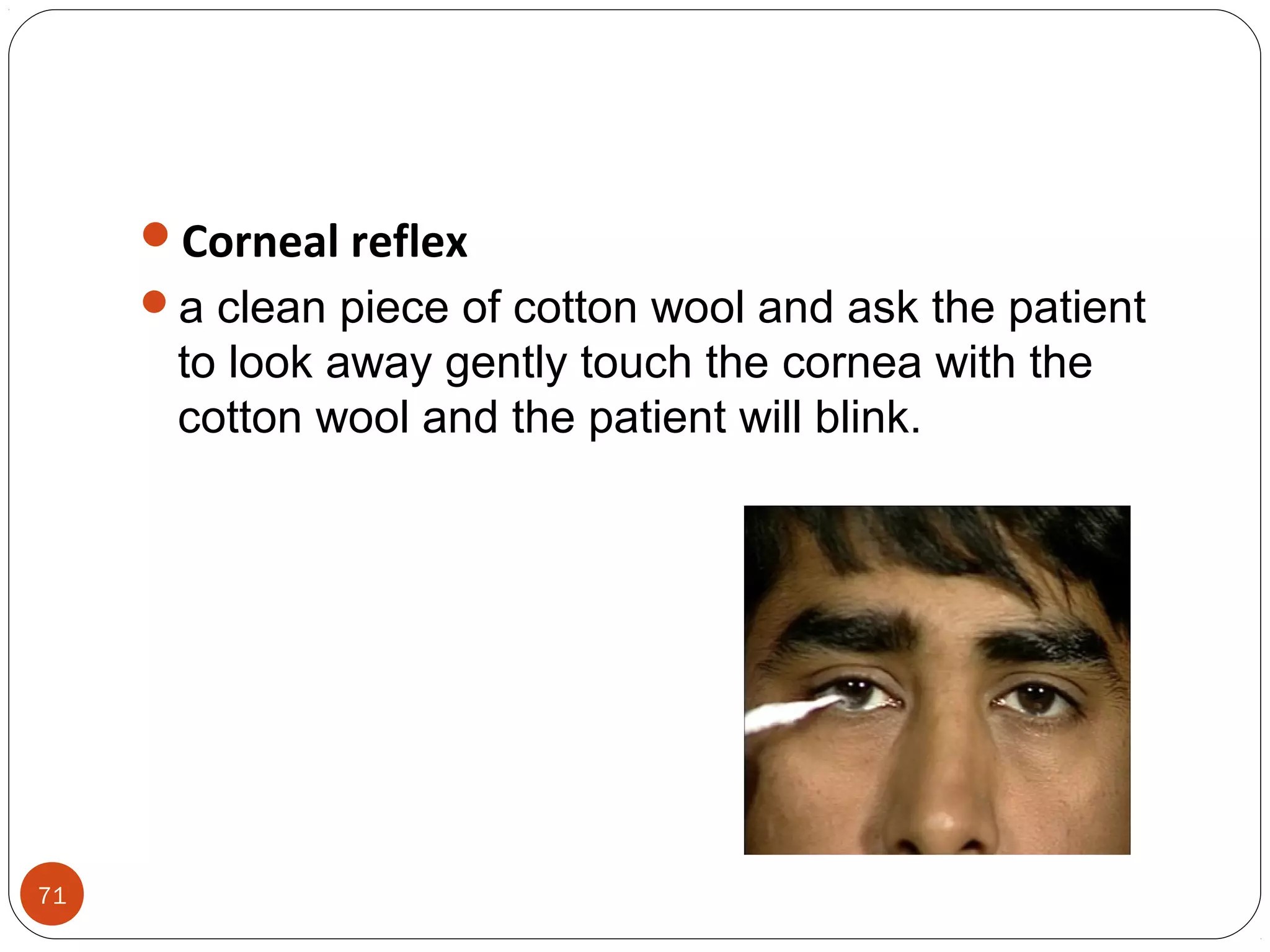 71
Corneal reflex
a clean piece of cotton wool and ask the patient
to look away gently touch the cornea with the
cotton wool and the patient will blink.
 