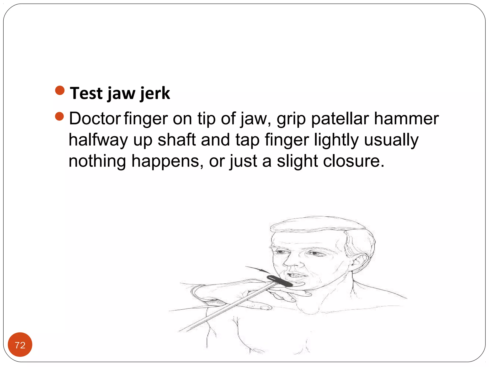 72
Test jaw jerk
Doctor finger on tip of jaw, grip patellar hammer
halfway up shaft and tap finger lightly usually
nothing happens, or just a slight closure.
 