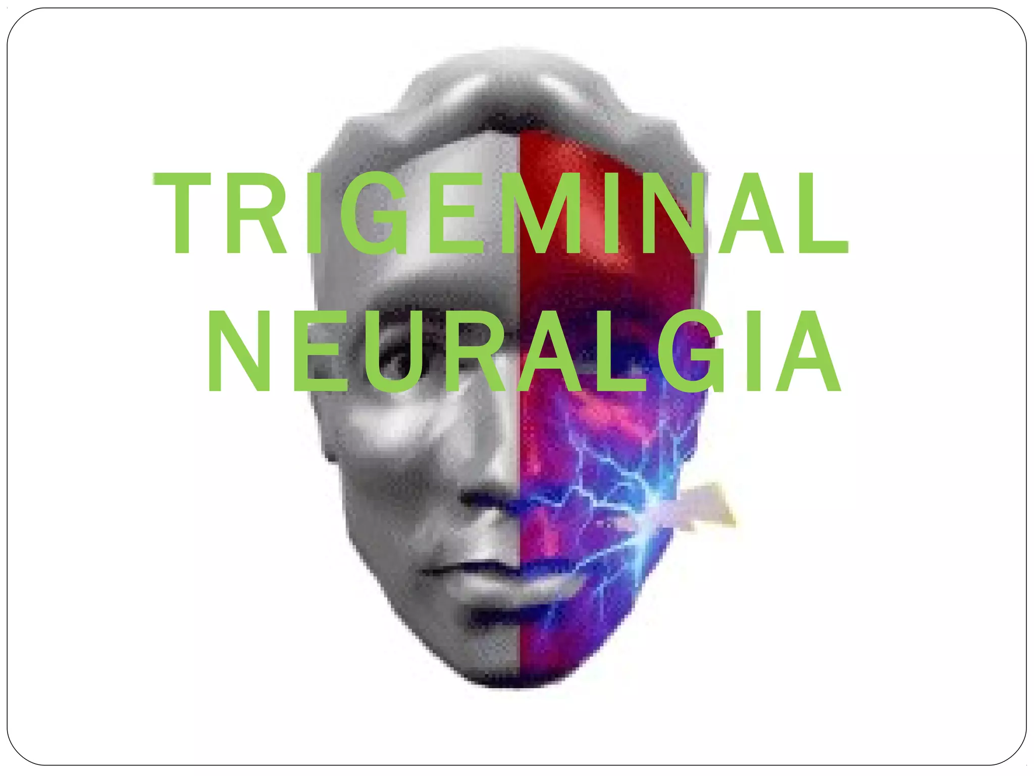 TRIGEMINAL
NEURALGIA
 