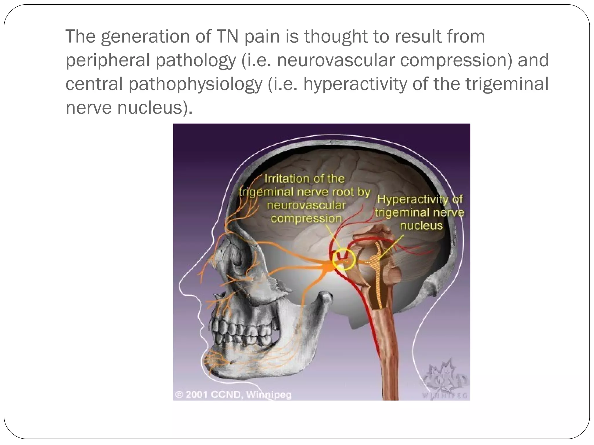 The generation of TN pain is thought to result from
peripheral pathology (i.e. neurovascular compression) and
central pathophysiology (i.e. hyperactivity of the trigeminal
nerve nucleus).
 