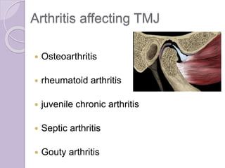 Arthritis affecting TMJ
 Osteoarthritis
 rheumatoid arthritis
 juvenile chronic arthritis
 Septic arthritis
 Gouty arthritis
 