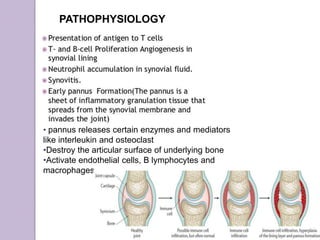 PATHOPHYSIOLOGY
• pannus releases certain enzymes and mediators
like interleukin and osteoclast
•Destroy the articular surface of underlying bone
•Activate endothelial cells, B lymphocytes and
macrophages
 