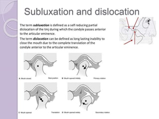 Subluxation and dislocation
 