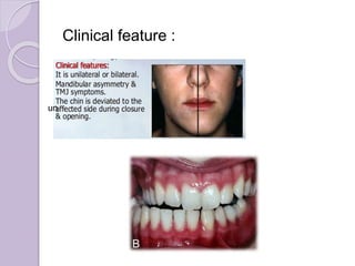 Clinical feature :
un
 