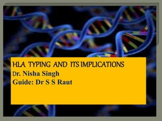 Dr Nisha Singh
Guide:Dr S .S RautHLA TYPING AND ITS IMPLICATIONS
Dr. Nisha Singh
Guide: Dr S S Raut
 