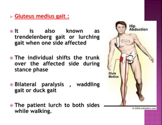  Gluteus medius gait :
 It is also known as
trendelenberg gait or lurching
gait when one side affected
 The individual shifts the trunk
over the affected side during
stance phase
 Bilateral paralysis , waddling
gait or duck gait
 The patient lurch to both sides
while walking.
 