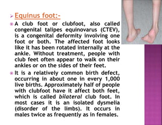  Equinus foot:-
 A club foot or clubfoot, also called
congenital talipes equinovarus (CTEV),
is a congenital deformity involving one
foot or both. The affected foot looks
like it has been rotated internally at the
ankle. Without treatment, people with
club feet often appear to walk on their
ankles or on the sides of their feet.
 It is a relatively common birth defect,
occurring in about one in every 1,000
live births. Approximately half of people
with clubfoot have it affect both feet,
which is called bilateral club foot. In
most cases it is an isolated dysmelia
(disorder of the limbs). It occurs in
males twice as frequently as in females.
 