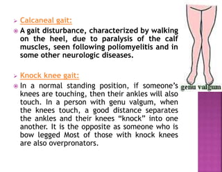  Calcaneal gait:
 A gait disturbance, characterized by walking
on the heel, due to paralysis of the calf
muscles, seen following poliomyelitis and in
some other neurologic diseases.
 Knock knee gait:
 In a normal standing position, if someone’s
knees are touching, then their ankles will also
touch. In a person with genu valgum, when
the knees touch, a good distance separates
the ankles and their knees “knock” into one
another. It is the opposite as someone who is
bow legged Most of those with knock knees
are also overpronators.
 