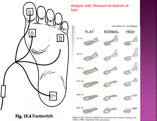 Analysis aids: Pressure on bottom of
feet
 