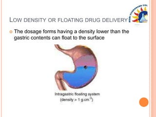 LOW DENSITY OR FLOATING DRUG DELIVERY
 The dosage forms having a density lower than the
gastric contents can float to the surface
 