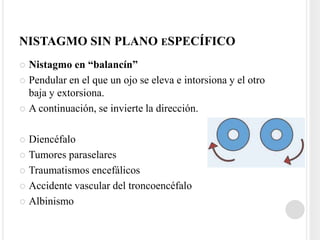 NISTAGMO SIN PLANO ESPECÍFICO
 Nistagmo en “balancín”
 Pendular en el que un ojo se eleva e intorsiona y el otro
  baja y extorsiona.
 A continuación, se invierte la dirección.



 Diencéfalo
 Tumores paraselares

 Traumatismos encefálicos

 Accidente vascular del troncoencéfalo

 Albinismo
 