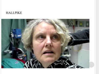 HALLPIKE
 