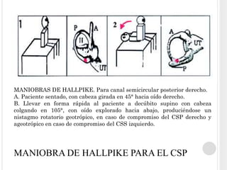 MANIOBRAS DE HALLPIKE. Para canal semicircular posterior derecho.
A. Paciente sentado, con cabeza girada en 45° hacia oído derecho.
B. Llevar en forma rápida al paciente a decúbito supino con cabeza
colgando en 105°, con oído explorado hacia abajo, produciéndose un
nistagmo rotatorio geotrópico, en caso de compromiso del CSP derecho y
ageotrópico en caso de compromiso del CSS izquierdo.




MANIOBRA DE HALLPIKE PARA EL CSP
 