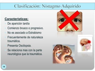 14
Características:
 De aparición tardía
 Comienzo brusco o progresivo.
 No es asociado a Estrabismo
 Frecuentemente de naturaleza
traumática.
 Presenta Oscilopsia.
 Se relaciona mas con la parte
neurológica que la traumática.
 