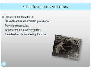 20
5.- Nistagmo de los Mineros:
 Se le denomina enfermedad profesional.
 Movimiento pendular.
 Desaparece en la convergencia
 Leve temblor de la cabeza y tortícolis.
 