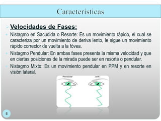 Velocidades de Fases:
 Nistagmo en Sacudida o Resorte: Es un movimiento rápido, el cual se
caracteriza por un movimiento de deriva lento, le sigue un movimiento
rápido corrector de vuelta a la fóvea.
 Nistagmo Pendular: En ambas fases presenta la misma velocidad y que
en ciertas posiciones de la mirada puede ser en resorte o pendular.
 Nistagmo Mixto: Es un movimiento pendular en PPM y en resorte en
visión lateral.
 