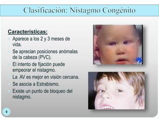 9
Características:
 Aparece a los 2 y 3 meses de
vida.
 Se aprecian posiciones anómalas
de la cabeza (PVC).
 El intento de fijación puede
empeorar el nistagmo.
 La AV es mejor en visión cercana.
 Se asocia a Estrabismo.
 Existe un punto de bloqueo del
nistagmo.
 