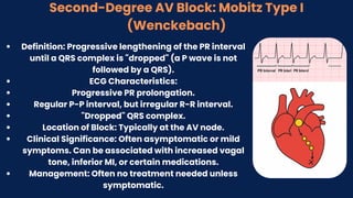 Second-Degree AV Block: Mobitz Type I
(Wenckebach)
Definition: Progressive lengthening of the PR interval
until a QRS complex is "dropped" (a P wave is not
followed by a QRS).
ECG Characteristics:
Progressive PR prolongation.
Regular P-P interval, but irregular R-R interval.
"Dropped" QRS complex.
Location of Block: Typically at the AV node.
Clinical Significance: Often asymptomatic or mild
symptoms. Can be associated with increased vagal
tone, inferior MI, or certain medications.
Management: Often no treatment needed unless
symptomatic.
 