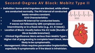 Second-Degree AV Block: Mobitz Type II
Definition: Some atrial impulses are blocked, while others
are conducted normally. The PR interval of conducted
beats remains constant.
ECG Characteristics:
Constant PR interval for conducted beats.
P waves not followed by QRS complexes occur
intermittently or in a fixed ratio (e.g., 2:1, 3:1 block).
Location of Block: Usually below the AV node (Bundle of
His or bundle branches).
Clinical Significance: More serious than Mobitz Type I.
Higher risk of progressing to complete heart block. More
likely to be symptomatic.
Management: Often requires pacemaker implantation,
especially if symptomatic or if the block is infrahisian.
 
