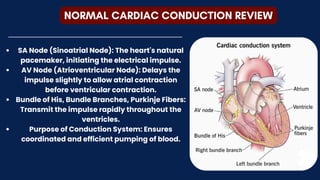 NORMAL CARDIAC CONDUCTION REVIEW
SA Node (Sinoatrial Node): The heart's natural
pacemaker, initiating the electrical impulse.
AV Node (Atrioventricular Node): Delays the
impulse slightly to allow atrial contraction
before ventricular contraction.
Bundle of His, Bundle Branches, Purkinje Fibers:
Transmit the impulse rapidly throughout the
ventricles.
Purpose of Conduction System: Ensures
coordinated and efficient pumping of blood.
 