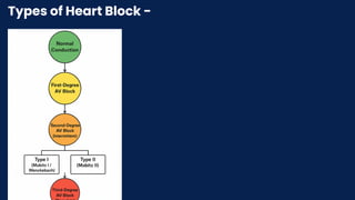 Types of Heart Block -
 