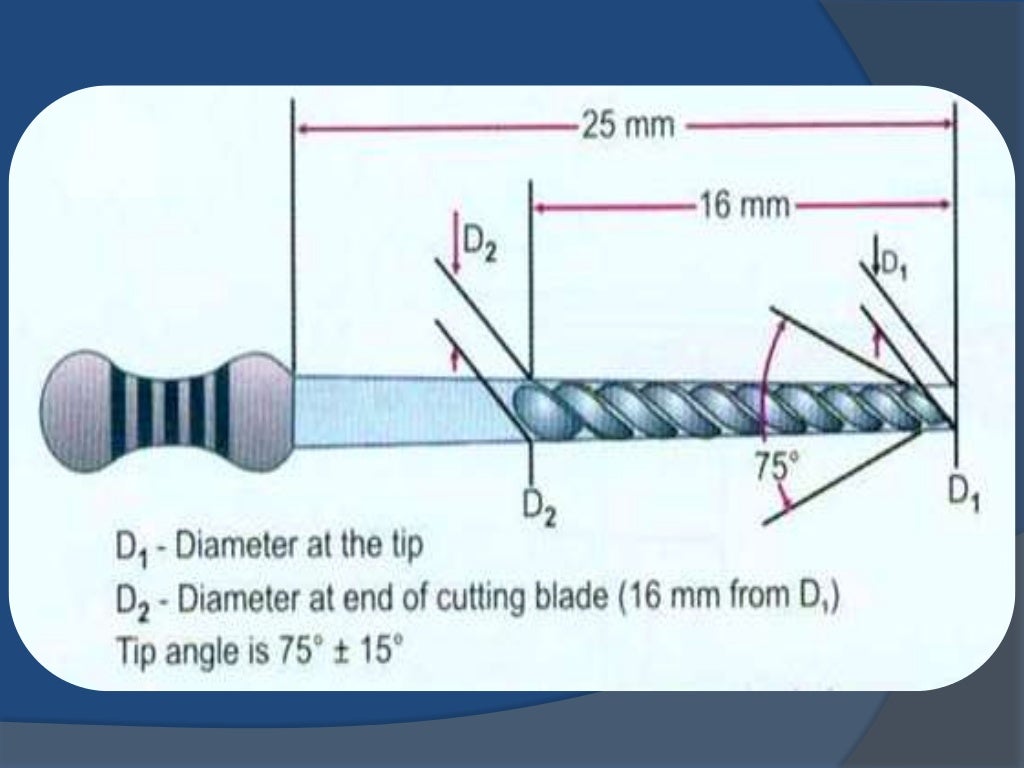 Nickel Titanium in Endodontics