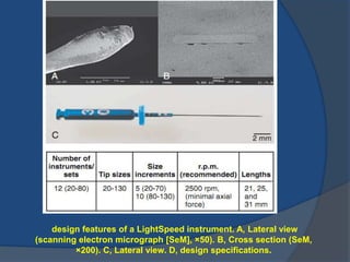 design features of a LightSpeed instrument. A, Lateral view
(scanning electron micrograph [SeM], ×50). B, Cross section (SeM,
×200). C, Lateral view. D, design specifications.
 