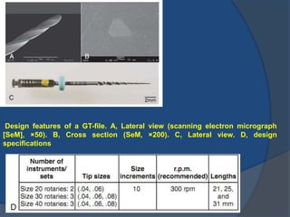 Design features of a GT-file. A, Lateral view (scanning electron micrograph
[SeM], ×50). B, Cross section (SeM, ×200). C, Lateral view. D, design
specifications
 