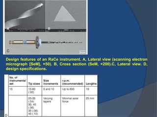 Design features of an RaCe instrument. A, Lateral view (scanning electron
micrograph [SeM], ×50). B, Cross section (SeM, ×200).C, Lateral view. D,
design specifications.
 