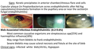 Nitin endophthalmitis prevention and management | PPTX