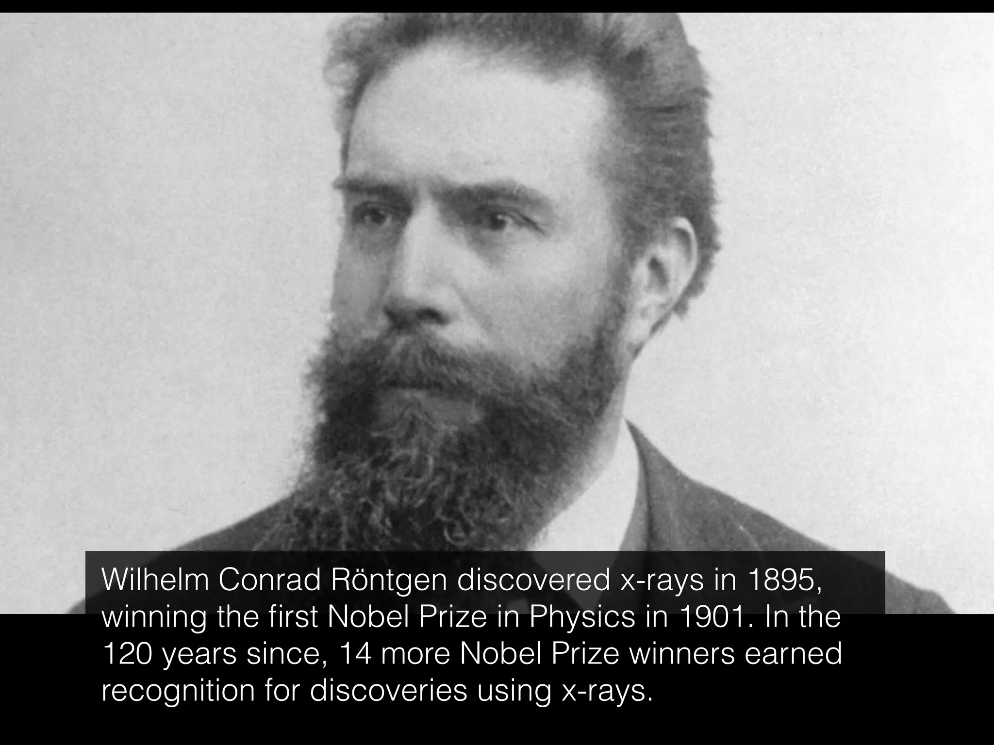 Wilhelm Conrad Röntgen discovered x-rays in 1895,
winning the first Nobel Prize in Physics in 1901. In the
120 years since, 14 more Nobel Prize winners earned
recognition for discoveries using x-rays.
